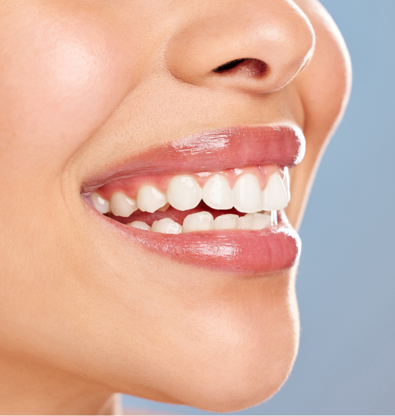 Smiling woman outside with healthy teeth
